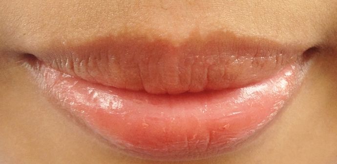 How To Lighten Dark Lips With Home Remedies